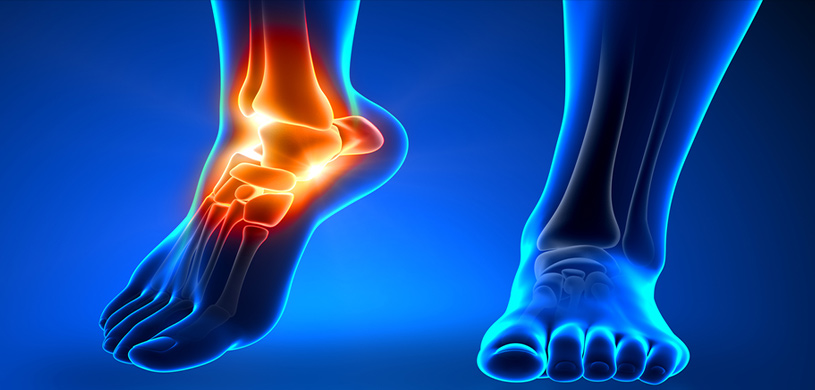 ANKLE